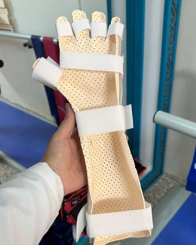 الأطراف العلوية